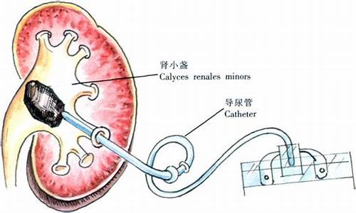 肾穿刺代表什么生肖_肾穿刺代表病很重