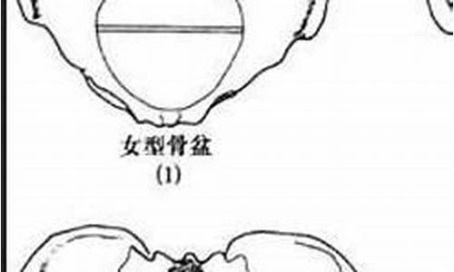 扁平骨盆是指骨盆对角径小于多少厘米_扁平骨盆像什么生肖